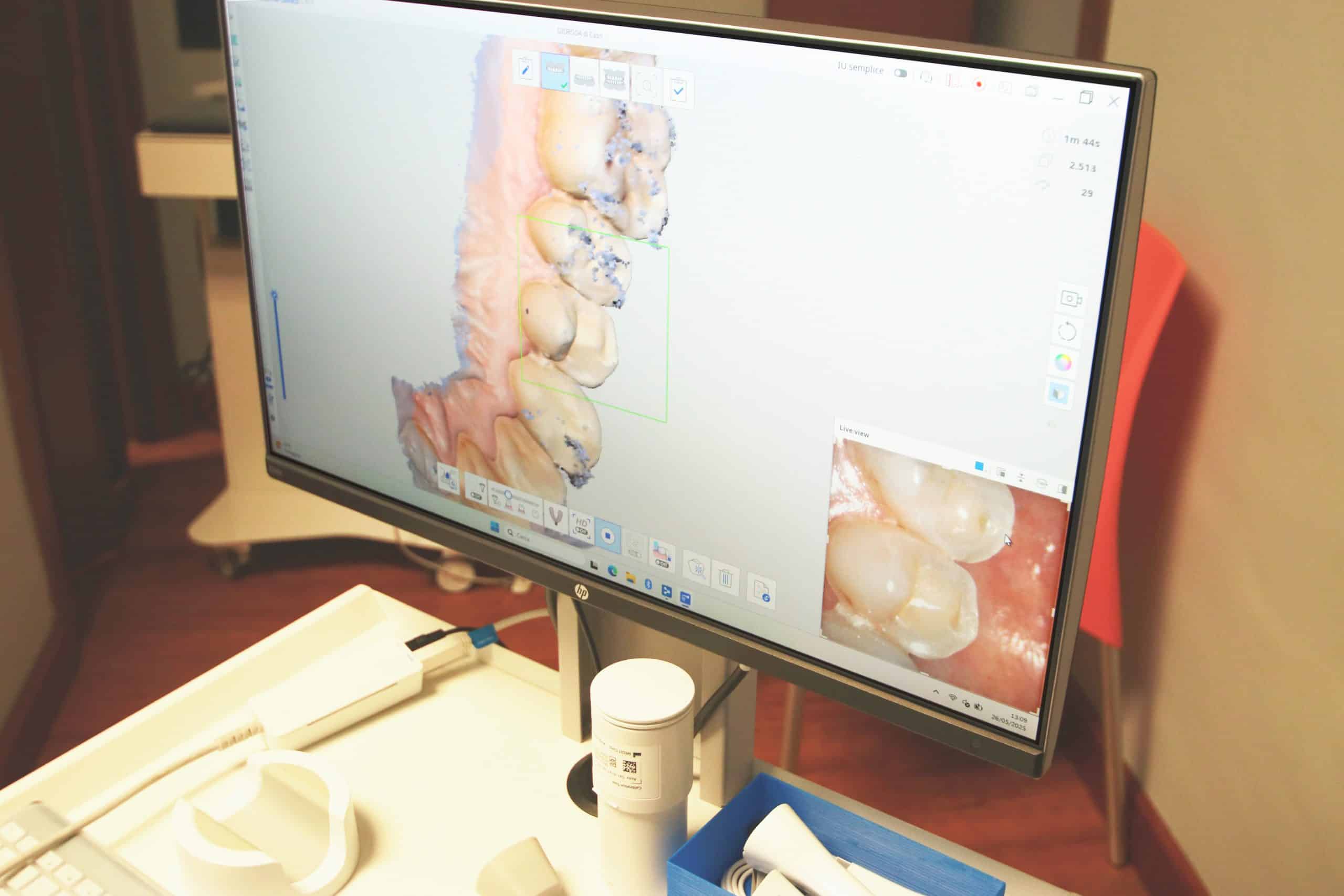 Schermo con immagine 3D di denti su software odontoiatrico.